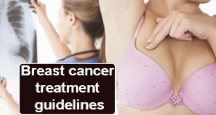 Breast cancer treatment guidelines