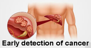 Early detection of cancer