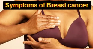 Symptoms of Breast cancer