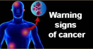 Warning signs of cancer in your body