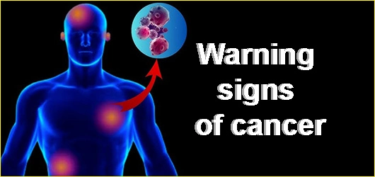 Warning signs of cancer in your body